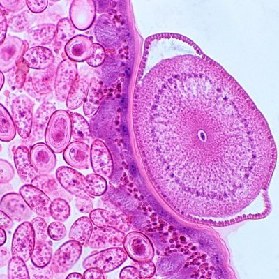 фото вируса герпеса сделанное лазерным микроскопом