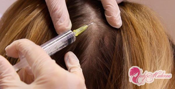 мезотерапия волос витаминами