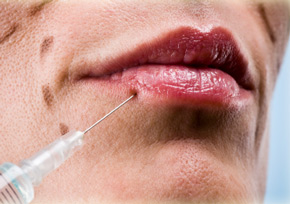инъекции для уличения губ